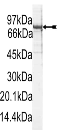 Eurofins DiscoverX PKC I Protein, Active 10 &mu;g | Buy Online | Eurofins DiscoverX | Fisher Scientific